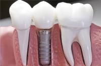 Princeton Dental Group image 4
